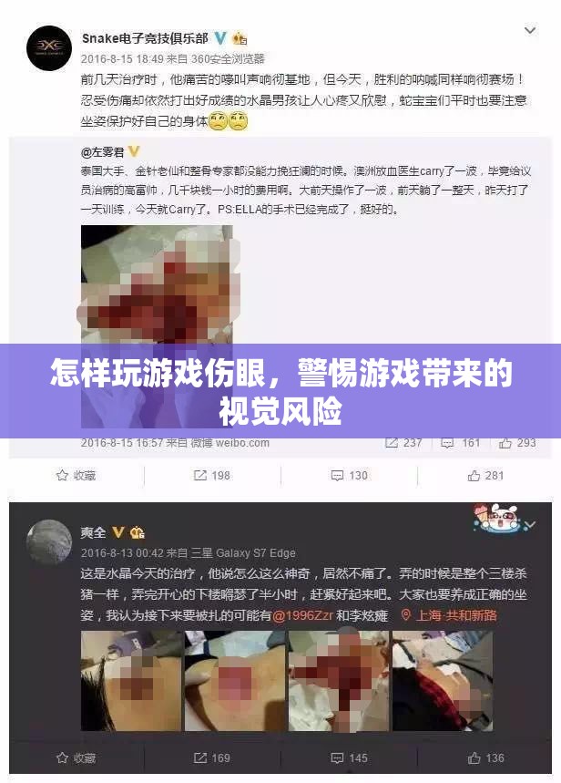 游戲傷眼，警惕視覺風(fēng)險