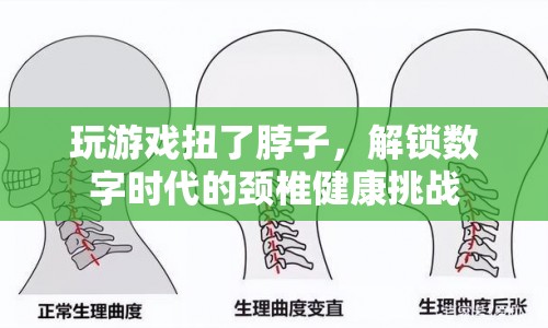 數(shù)字時代下的頸椎健康挑戰(zhàn)，玩游戲不慎扭了脖子